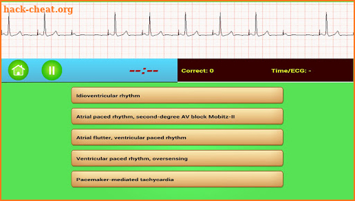 ECG Rhythm screenshot