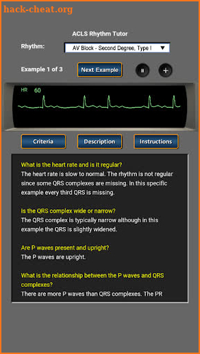 ECG Rhythm and Pulse screenshot