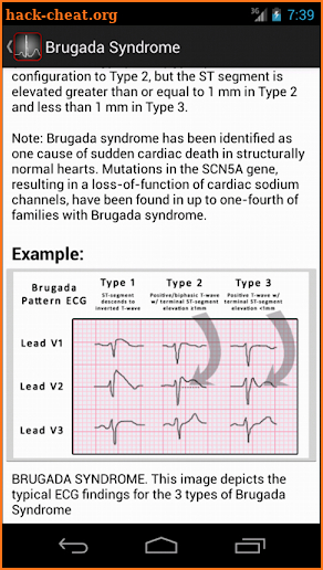 ECGsource screenshot