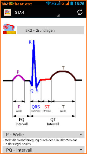 EKG-Monitoring screenshot