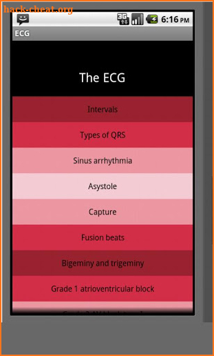 Electrocardiogram ECG Types screenshot