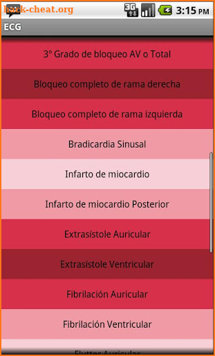 Electrocardiograma ECG Tipos screenshot