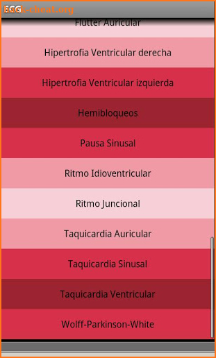 Electrocardiograma ECG Tipos screenshot