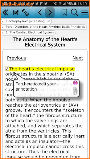 Electrophysiologic Testing, 5 screenshot