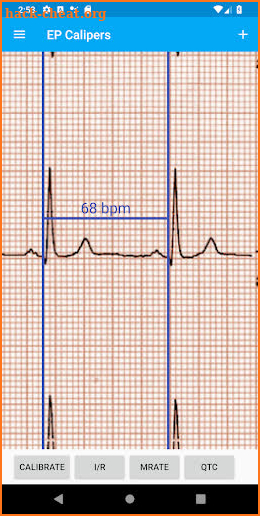 EP Calipers screenshot