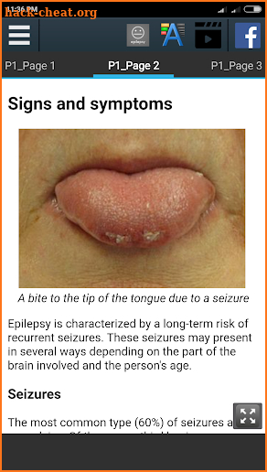 Epilepsy Info screenshot