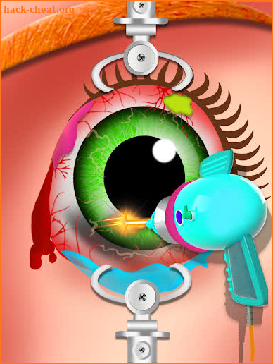 Eye Doctor Surgery Simulator screenshot