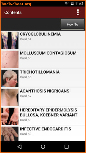 Fitzpatrick's Dermatology Flash Cards screenshot