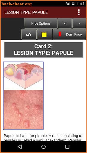 Fitzpatrick's Dermatology Flash Cards screenshot