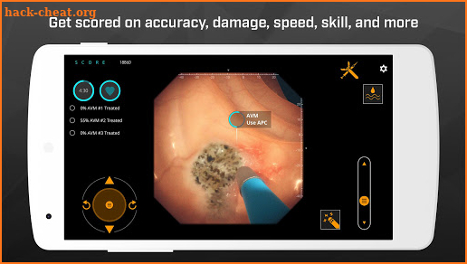 Gastro Ex – Scope. Biopsy. APC. Train. screenshot