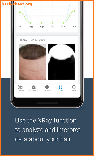 HairLog: Track Your Hair Regrowth screenshot