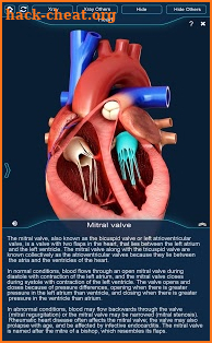 Heart Anatomy Pro. screenshot