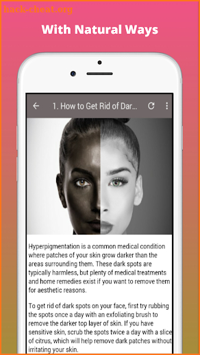 How To Get Rid Of Dark Spots screenshot