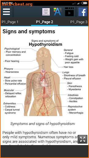 Hypothyroidism Info screenshot