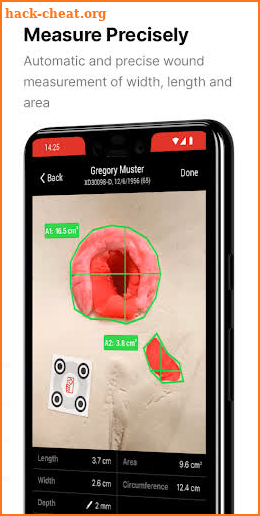 imitoWound - Digital Woundcare screenshot