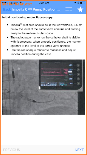 Impella App screenshot