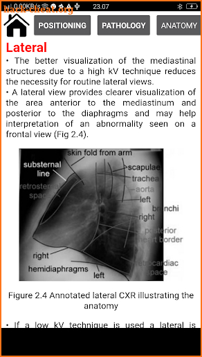 Interpretation Chest X Ray screenshot