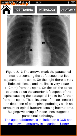 Interpretation Chest X Ray screenshot