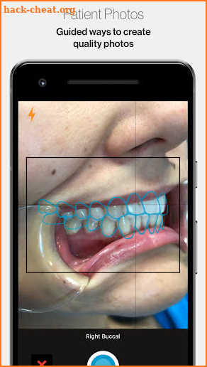 Invisalign Photo Uploader screenshot