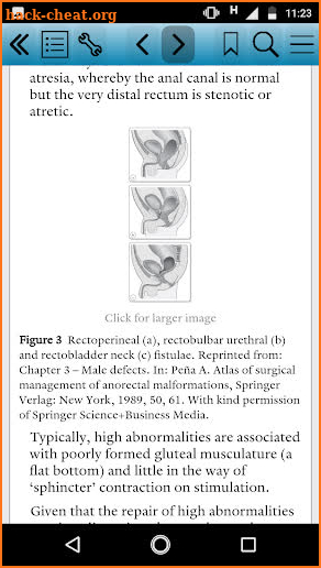 Key Clinical Topics in Paediatric Surgery screenshot