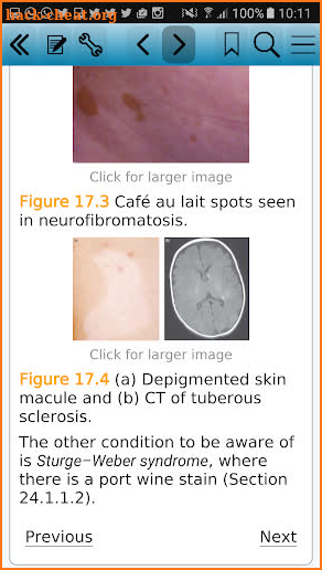 Lecture Notes: Paediatrics, 9 screenshot