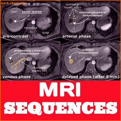 Magnetic Resonance Imaging Sequences screenshot