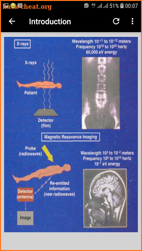 Magnetic Resonance Imaging Sequences screenshot