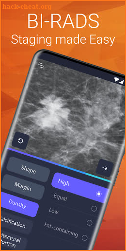 Mammography Assistant screenshot