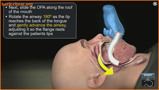 Medrills: Airway Management screenshot