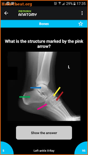 Memorix Anatomy QUIZ screenshot