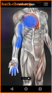 Muscle Trigger Point Anatomy screenshot