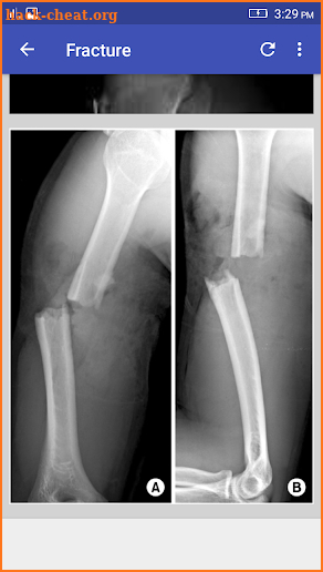 Musculoskeletal X- Rays Interpretation screenshot