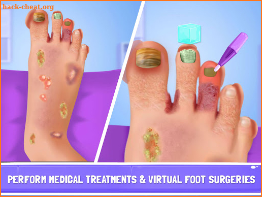 Nail Surgery Foot Doctor - Offline Surgeon Games screenshot