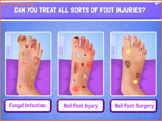 Nail Surgery Foot Doctor - Offline Surgeon Games screenshot