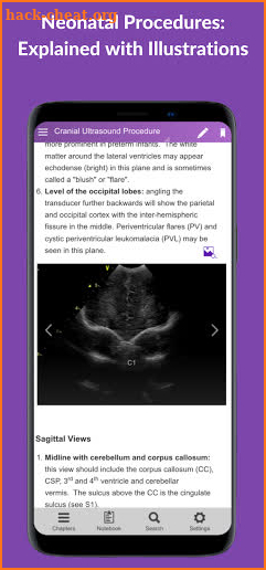 Neonatal Guide screenshot