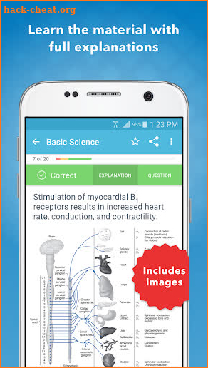 Nurse Anesthesia CRNA Review screenshot