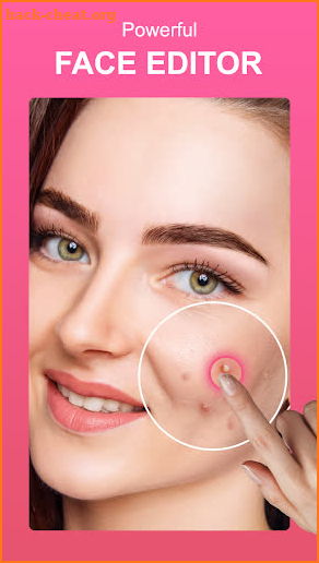 Pimple Remover Photo Editor screenshot