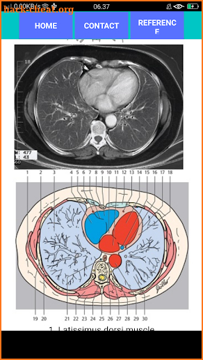 POCKET ATLAS CT THORAX screenshot