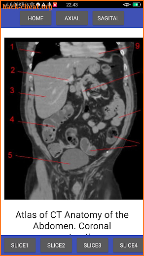 Pocket Atlas of CT ABDOMEN screenshot