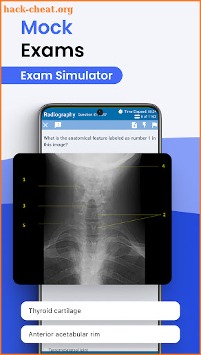 Prepry - ARRT Rad Exam Prep screenshot