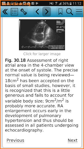 Pulmonary Hypertension screenshot