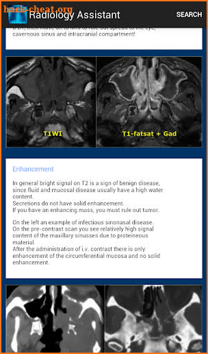 Radiology Assistant screenshot