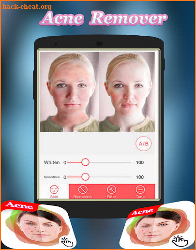 Remove pimples from photo -Acne And Pimple Remover screenshot