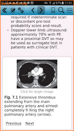 Respiratory Disease screenshot