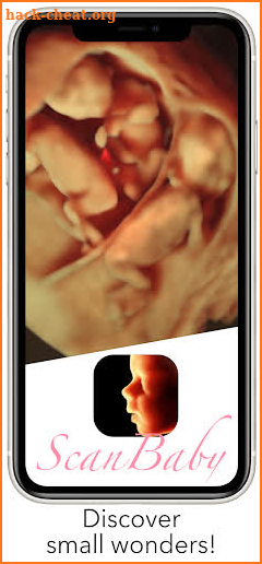 ScanBaby learn baby ultrasound screenshot