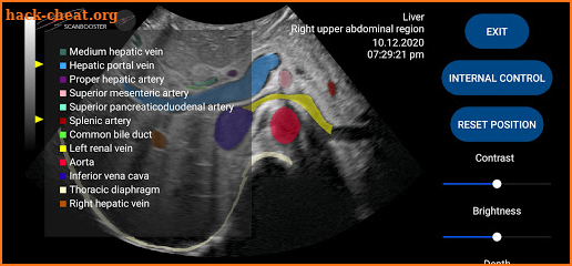 Scanbooster Ultrasound Simulator screenshot