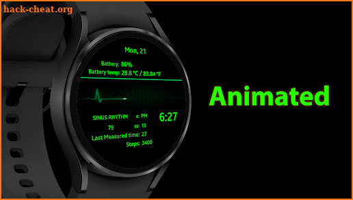 Sinus Rhythm (ECG) - Luxsank screenshot