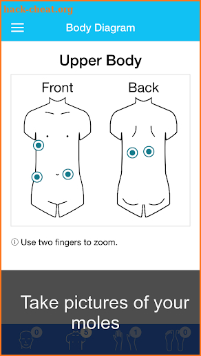 Skin Cancer App - MySkinPal screenshot