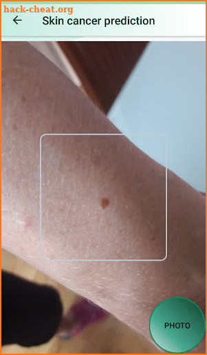 Skin Cancer Risk Prediction screenshot