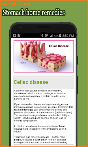 Stomach Diseases and Treatment screenshot